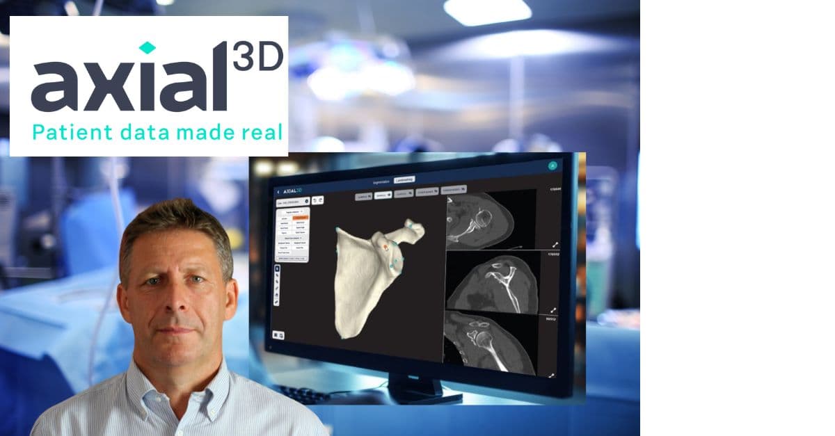LinkedIn post preview for Axial3D