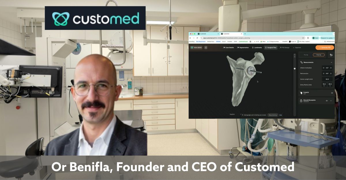 LinkedIn post preview for CustoMED